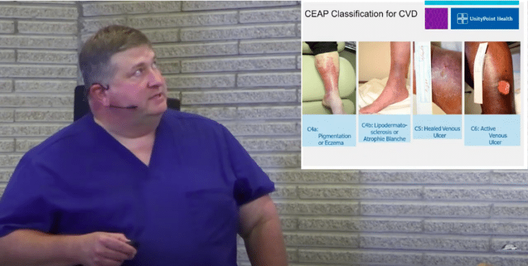 Chronic Venous Disease with Mark Williams, MD | UnityPoint Trinity Muscatine